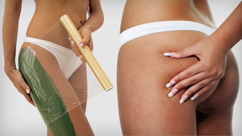 Как избавиться от целлюлита?