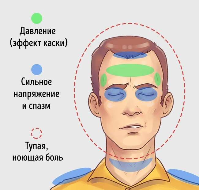 Типы головных болей фото картинки