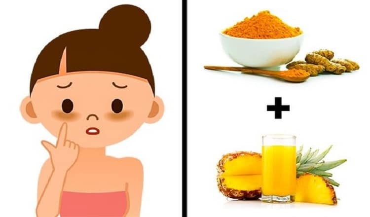 8 средств для удаления прыщей,шрамов и пигментных пятен на лице