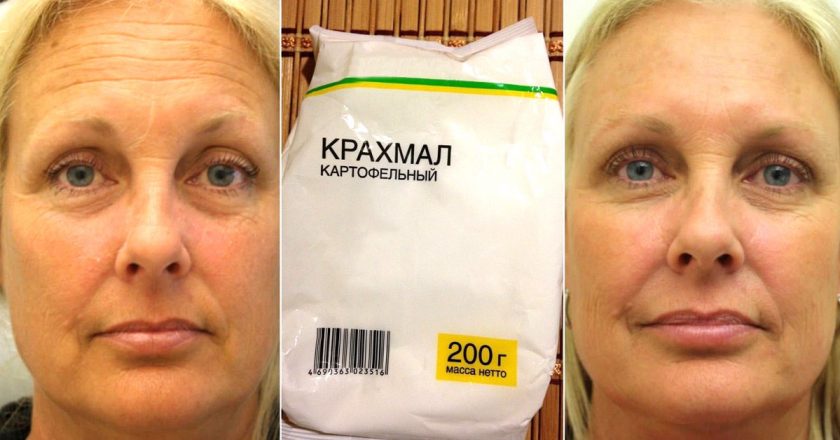 Маска-ботокс из крахмала. 15 минут — и результат будто после нескольких уколов в салоне красоты. Пробовала покупные. Всё не то. Маска-ботокс из крахмала. 15 минут — и результат будто после нескольких уколов в салоне красоты. Пробовала покупные. Всё не то.